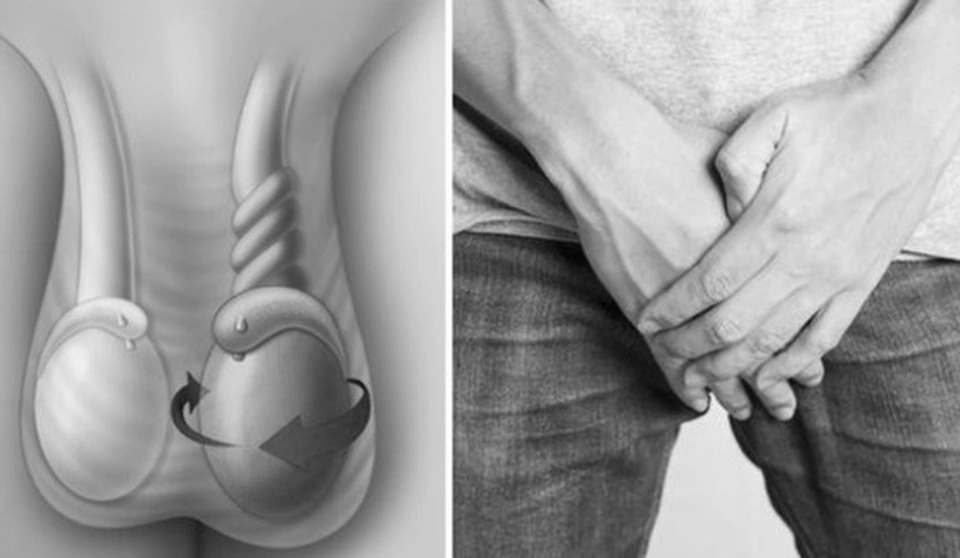 Xoắn tinh hoàn có dấu hiệu đau dữ dội